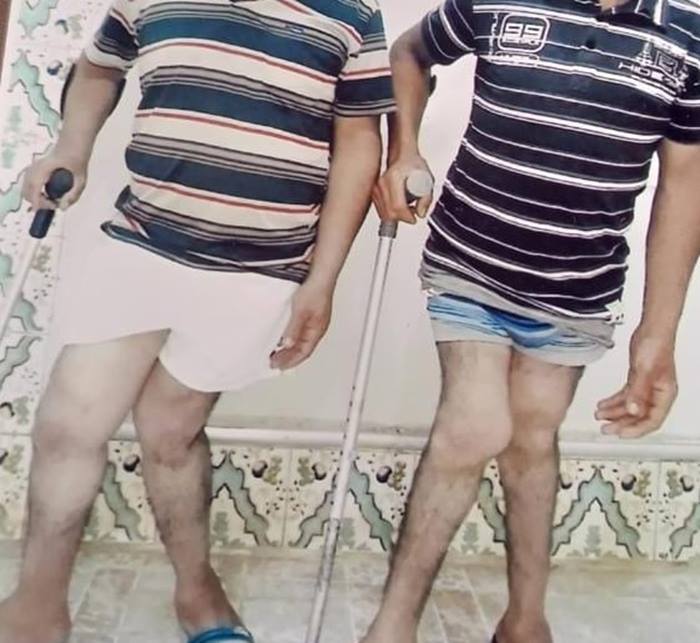 سيدي بنور.. معاقان يطالبان مسؤولي العمالة التدخل من أجل تفعيل طلبهما الحصول على محل تجاري مؤقت كمصدر رزق